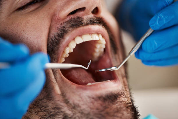 Best Emergency Dental Care for Broken or Chipped Teeth in Valley View, OH